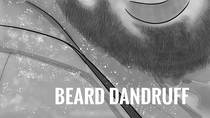 Beard Oil Fights Beard Dandruff