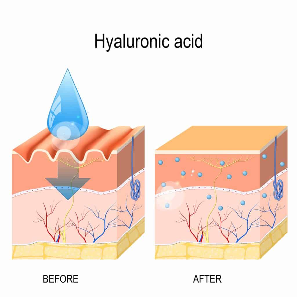 Hyaluronic Acid