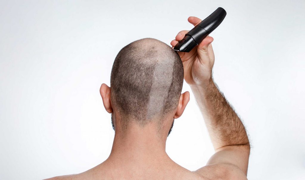 best balding clippers