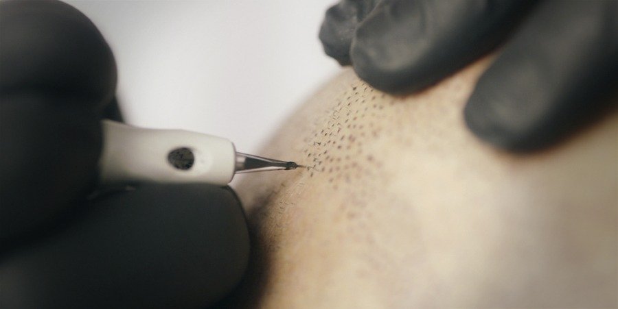 micropigmentation