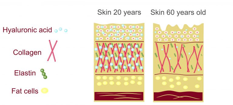 hyaluronic acid